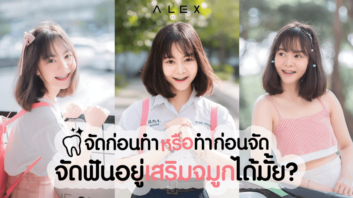 จัดก่อนทำหรือทำก่อนจัด จัดฟันอยู่เสริมจมูกได้มั้ย ?