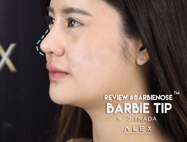 BARBIE NOSE™ - DR.ALEX