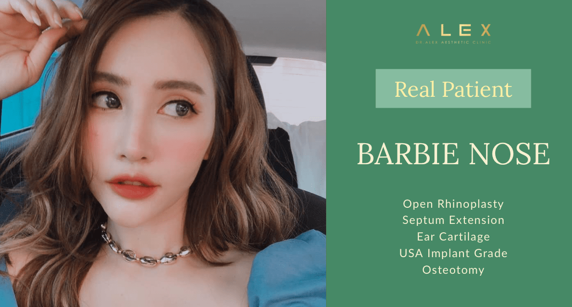 BARBIE NOSE | แก้จมูกที่ไหนดี แก้จมูกเทคนิคไหนดี มาดูกัน