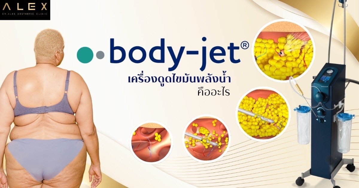 ดูดไขมัน Body Jet คืออะไร - DR.ALEX