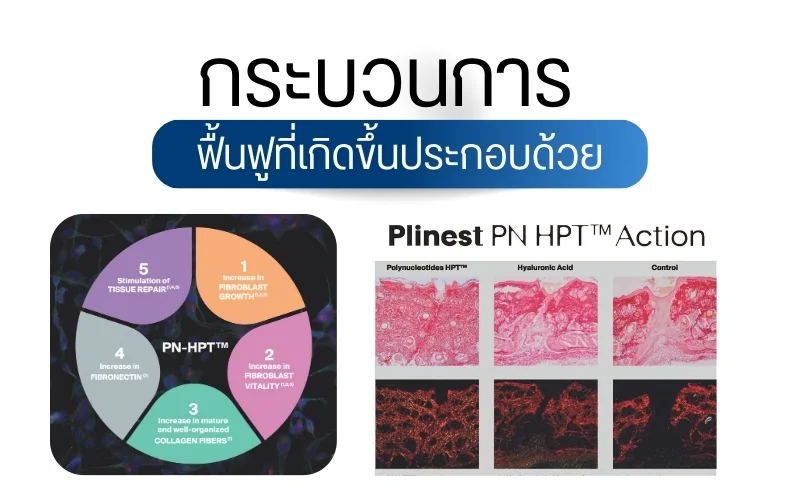 กระบวนการฟื้นฟูที่เกิดขึ้นประกอบด้วย