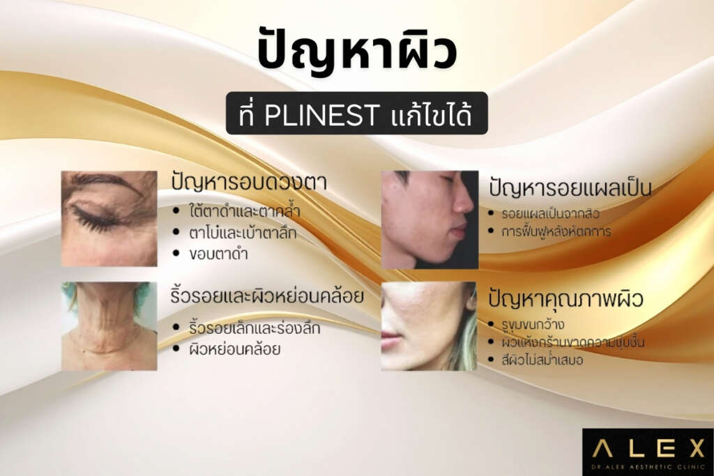 ปัญหาผิว