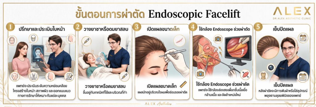 การดึงหน้าแบบส่องกล้อง แผลเล็ก ฟื้นตัวไว