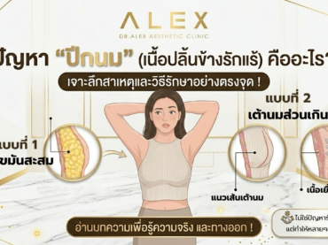ปัญหา “ปีกนม” เนื้อปลิ้นข้างรักแร้คืออะไร?