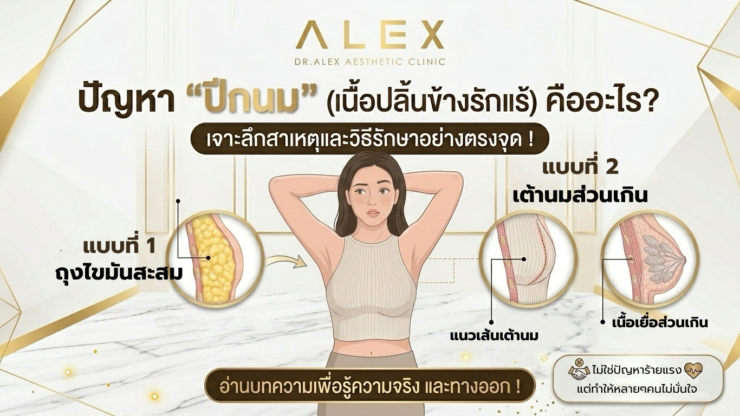 ปัญหา “ปีกนม” เนื้อปลิ้นข้างรักแร้คืออะไร?