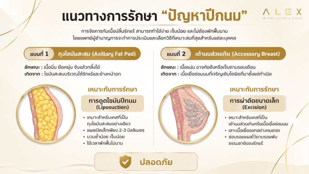 แนวทางการรักษาปัญหาปีกนมด้วยการดูดไขมันและผ่าตัดเต้านมส่วนเกิน