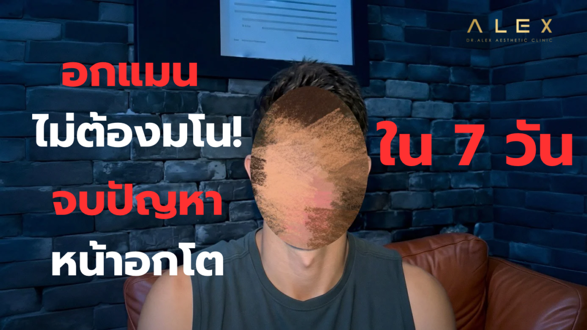 “บอกลาหน้าอกผู้หญิง! สรุปวิธีผ่าตัดแก้หน้าอกโต (Gynecomastia) พร้อมการดูแลตัวเองหลังทำ”