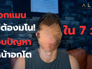 “บอกลาหน้าอกผู้หญิง! สรุปวิธีผ่าตัดแก้หน้าอกโต (Gynecomastia) พร้อมการดูแลตัวเองหลังทำ”