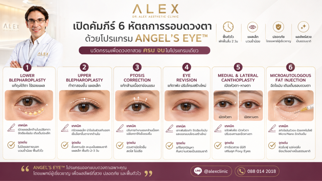 คู่มือ 6 หัตถการศัลยกรรมรอบดวงตาในโปรแกรม ANGEL’S EYE™ แผลเล็ก ฟื้นตัวไว สไตล์ Weekend Surgery ที่ Alex Clinic