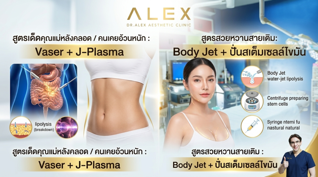 อินโฟกราฟิกเทรนด์คอมโบยอดนิยม: 'สูตรเด็ดหลังคลอด' (Vaser + J-Plasma) และ 'สูตรสายเติม' (Body Jet + สเต็มเซลล์) ที่ Dr. Alex Aesthetic Clinic แสดงเครื่องมือและผลลัพธ์