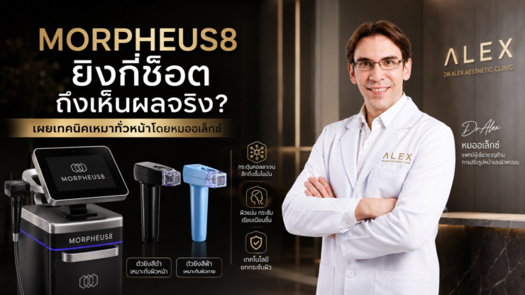 Morpheus8 ยิงกี่ช็อต ถึงเห็นผลจริง? เผยเทคนิคเหมาทั่วหน้าโดยหมออเล็กซ์