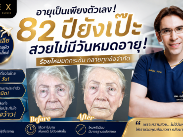 อายุ 82 มีเวลาแค่ 5 วัน แถมพกยามาเป็นถุง! ทำไมคุณยายออสเตรเลียถึงเลือก “ร้อยไหม” แทนผ่าตัดดึงหน้า?