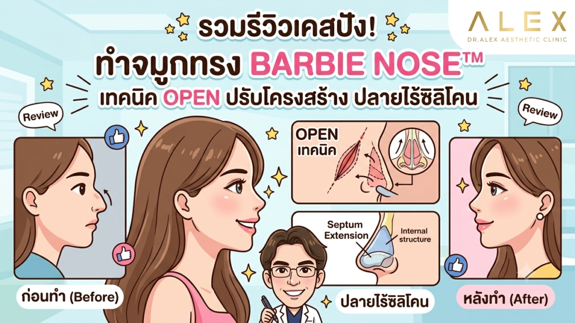 รวมรีวิวเคสปัง! ทำจมูกทรง Barbie Nose™ เทคนิค Open ปรับโครงสร้าง ปลายไร้ซิลิโคน ที่ Dr. Alex Clinic