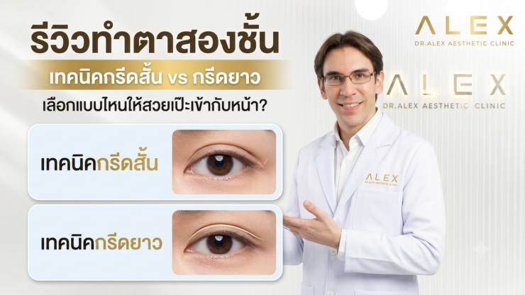 รีวิวทำตาสองชั้น เทคนิคกรีดสั้น vs กรีดยาว เลือกแบบไหนให้สวยเป๊ะเข้ากับหน้า? | Dr. Alex Clinic