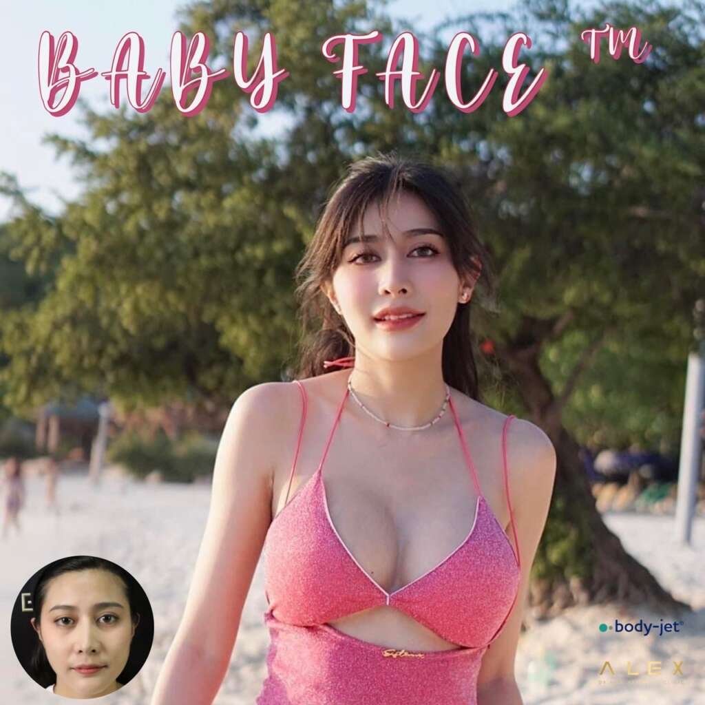 เติมไขมันหน้าเด็ก เทคนิคสเต็มเซลล์ฟื้นฟูผิวโกลว์ฉ่ำวาวหน้าอิ่มฟูสุขภาพดีอย่างธรรมชาติท้าแสงแดด