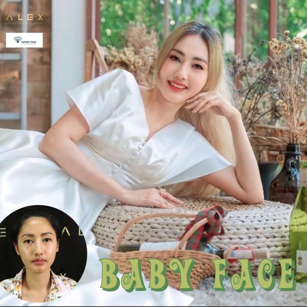 รีวิวเติมไขมันหน้าเด็กปรับโครงหน้าหวานละมุนลดอายุให้ผิวหน้าดูอิ่มฟูสุขภาพดีอย่างธรรมชาติ