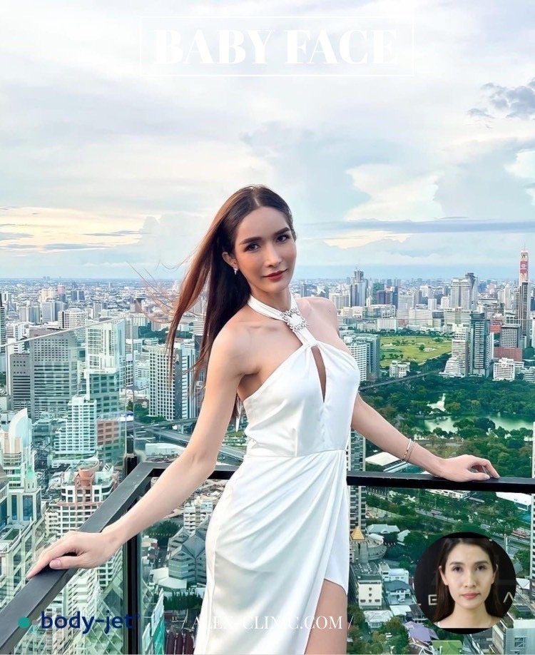 ดีไซน์มิติใบหน้าอวบอิ่มด้วยการเติมไขมันหน้าเด็กปรับรูปหน้าให้หน้าอิ่มฟูเปล่งปลั่งสุขภาพดีอย่างธรรมชาติ
