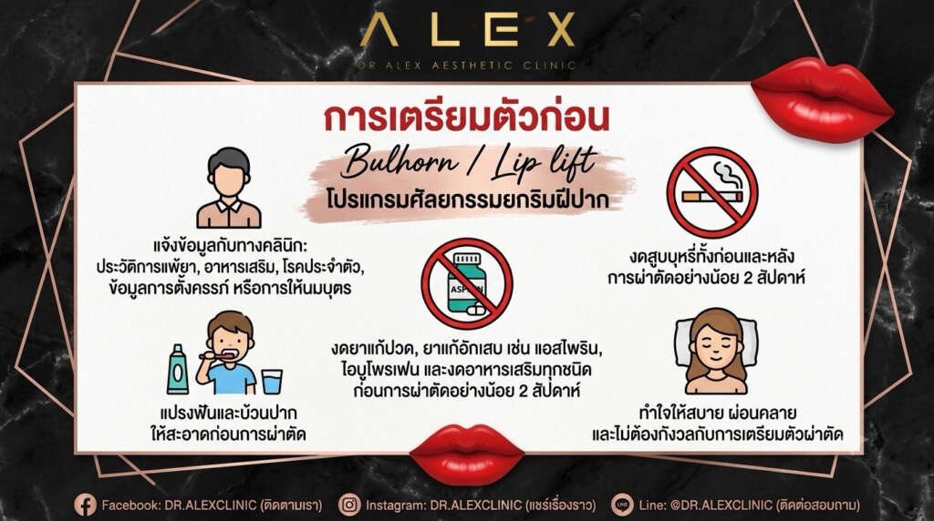 อินโฟกราฟิกแนะนำขั้นตอนการเตรียมตัวก่อนทำ ยกริมฝีปากบน (Bulhorn Lip Lift) โดย Dr. Alex Aesthetic Clinic เพื่อความปลอดภัยและผลลัพธ์ที่ดีที่สุด