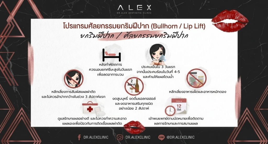 ยกริมฝีปากบน (Bullhorn Lip Lift) โดย Dr. Alex Aesthetic Clinic แสดงขั้นตอนการดูแลแผลผ่าตัดอย่างละเอียด
