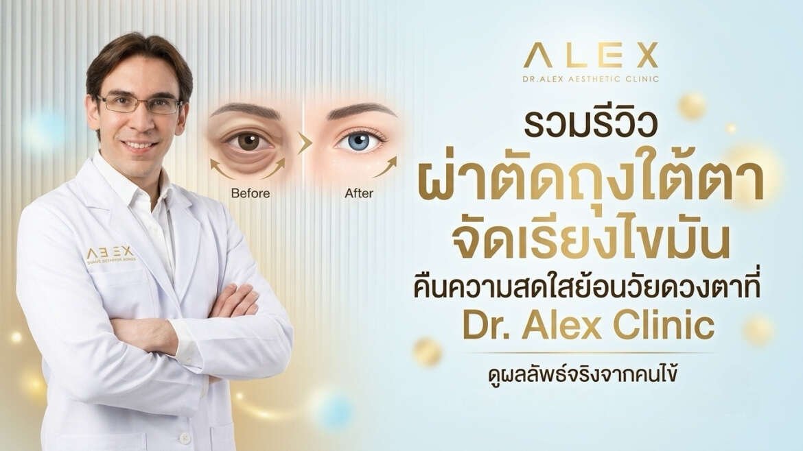 รวมรีวิว ผ่าตัดถุงใต้ตา จัดเรียงไขมัน คืนความสดใสย้อนวัยดวงตาที่ Dr. Alex Clinic