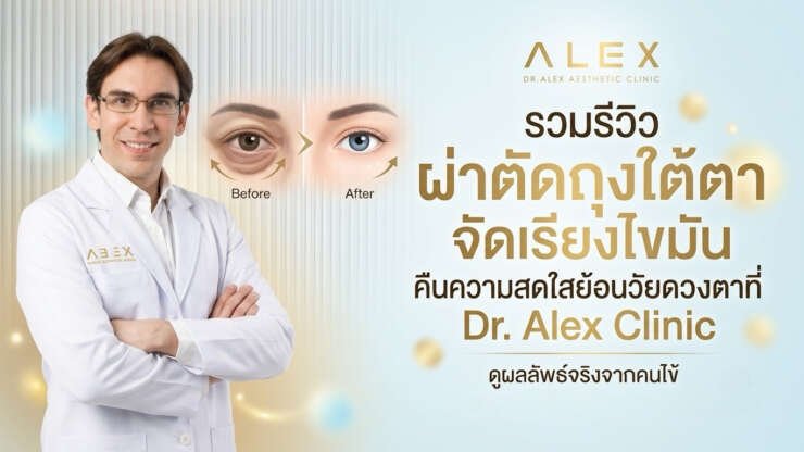 รวมรีวิว ผ่าตัดถุงใต้ตา จัดเรียงไขมัน คืนความสดใสย้อนวัยดวงตาที่ Dr. Alex Clinic